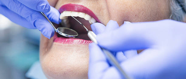 Best Knocked-Out Tooth (Avulsed Tooth) Treatment in Tn Lakes, WI